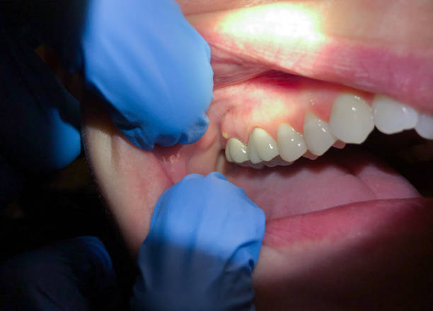 Best Emergency Dental Surgery in Indianola, WA