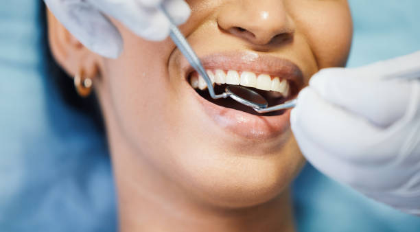 Best Emergency Treatment for Toothache in Indianola, WA